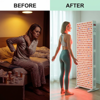 Red Light Therapy Full Body Panel, 480/630/660/810/830/850/1060Nm Blue Red near Infrared Light Device with 480 Dual Chip Clinical Grade Leds, Remote Control, Timer for Face, Body, BO-2400 — Before & After